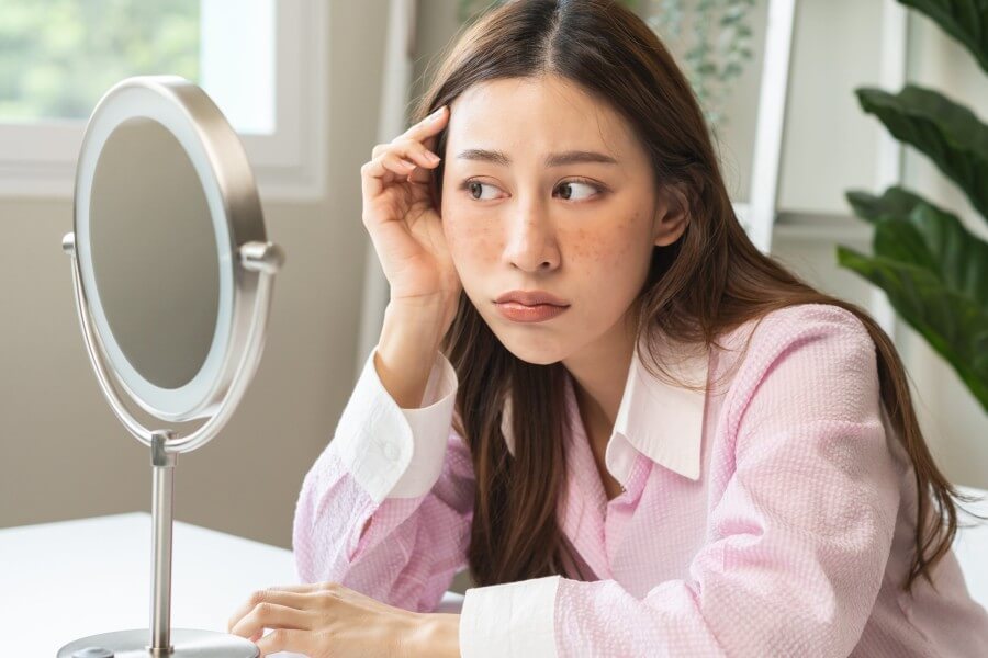 Mách bạn cách trị nám bằng lá tía tô đơn giản tại nhà